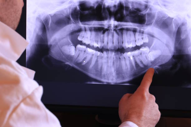 Best Holiday Emergency Dentist in Crothersville, IN