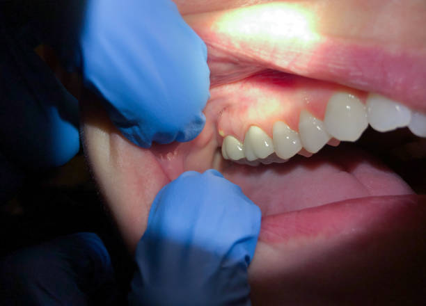 Best Orthodontic Emergency Dentist in Crothersville, IN