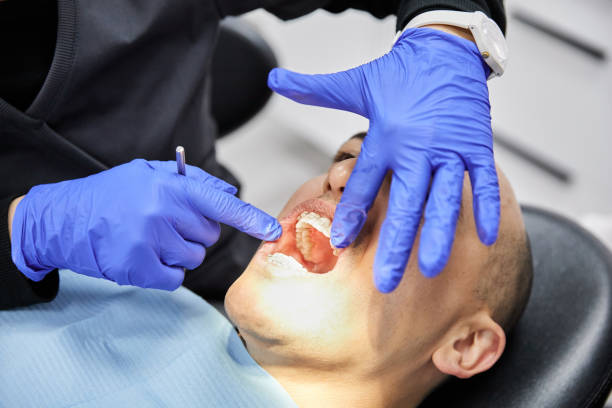 Best Emergency Root Canal Treatment in Crothersville, IN